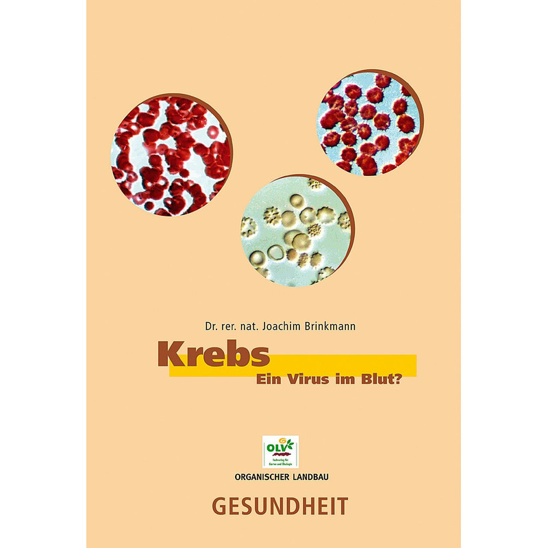 Krebs -  Ein Virus im Blut? - Dr. rer. nat. Joachim Brinkmann